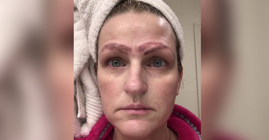 Read more about the article ‘I looked hideous’: Botched microblading procedure leaves metro woman with ‘crazy brows’