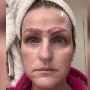 Read more about the article ‘I looked hideous’: Botched microblading procedure leaves metro woman with ‘crazy brows’